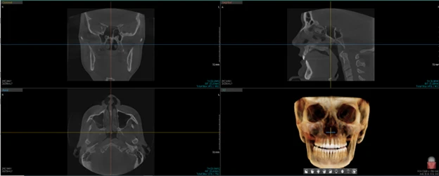 Ct Imaging Scan