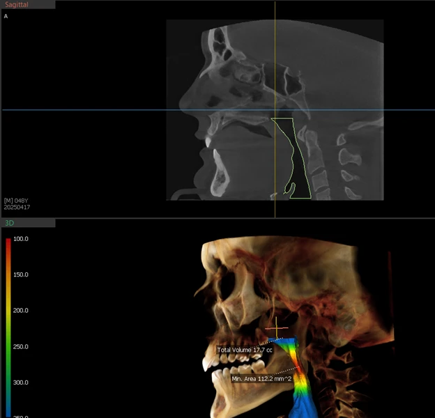 Airway Scan