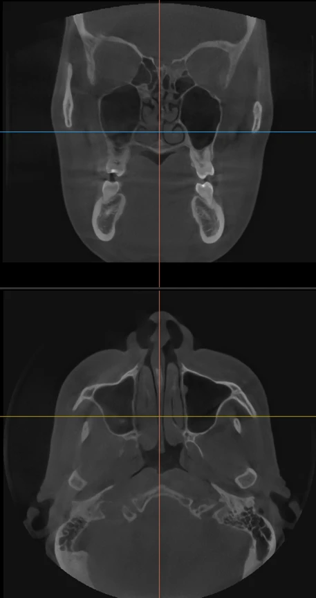 Mouth Scan